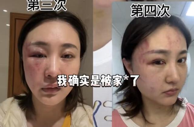 抖音吃瓜爆料網(wǎng)站下載，抖音爆料的吃瓜是真的嗎？