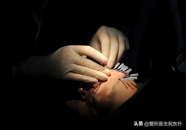 提拉緊致做什么醫(yī)美項(xiàng)目好（什么醫(yī)美可以提拉緊致）
