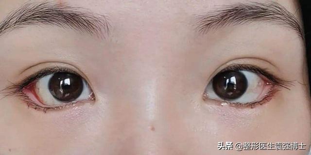 醫(yī)美項(xiàng)目名稱大全，醫(yī)美項(xiàng)目名稱大全表？