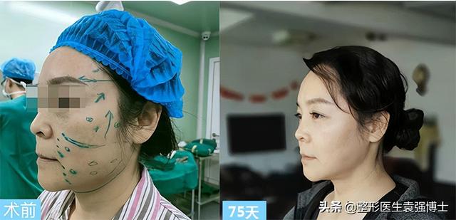 醫(yī)美項(xiàng)目，醫(yī)美項(xiàng)目都有哪些？