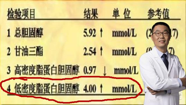 檢查血脂查什么項(xiàng)目多少錢，血脂檢查項(xiàng)目多少錢？