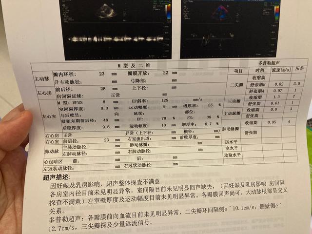 懷孕建檔需要做哪些檢查，懷孕建檔需要檢查什么？