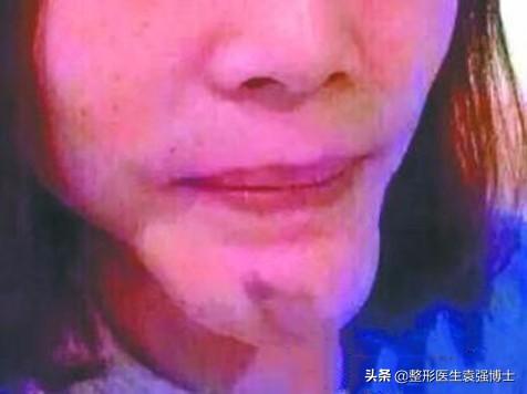 醫(yī)美項(xiàng)目名稱大全，醫(yī)美項(xiàng)目名稱大全表？