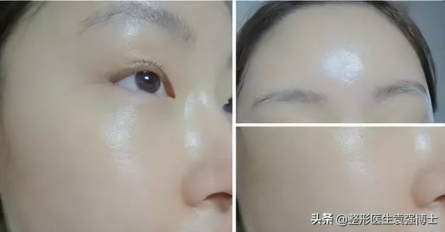 醫(yī)美項(xiàng)目，醫(yī)美項(xiàng)目都有哪些？