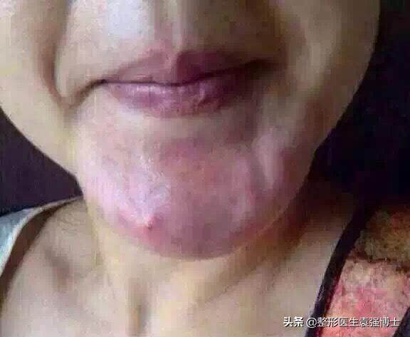 醫(yī)美項(xiàng)目名稱大全，醫(yī)美項(xiàng)目名稱大全表？