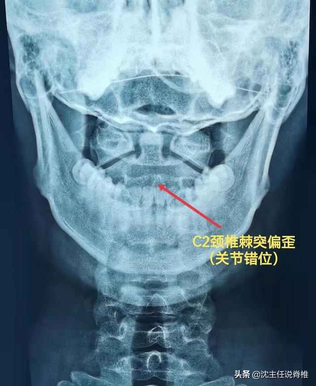 兒童頭暈檢查什么項(xiàng)目，兒童頭暈檢查什么項(xiàng)目好？