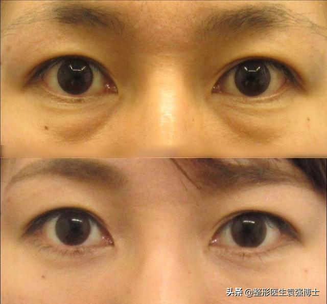 醫(yī)美項(xiàng)目，醫(yī)美項(xiàng)目都有哪些？