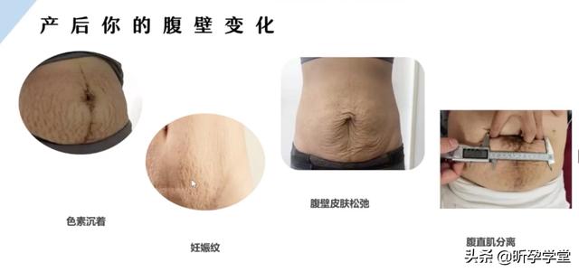 產(chǎn)后修復必做的項目有哪些多少錢，產(chǎn)后修復必做的項目有哪些多少錢可以做？