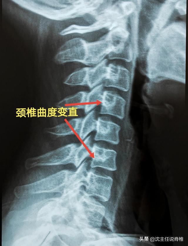 兒童頭暈檢查什么項(xiàng)目，兒童頭暈檢查什么項(xiàng)目好？