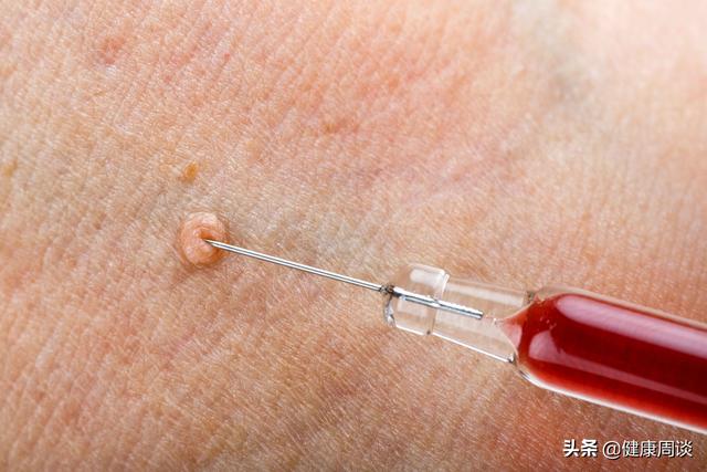 腋下長(zhǎng)了一個(gè)小疙瘩是什么東西按壓有點(diǎn)疼（腋下長(zhǎng)了一個(gè)小疙瘩按著疼）