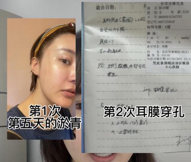 抖音吃瓜爆料網(wǎng)站下載，抖音爆料的吃瓜是真的嗎？