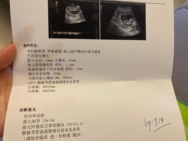 懷孕建檔需要做哪些檢查，懷孕建檔需要檢查什么？