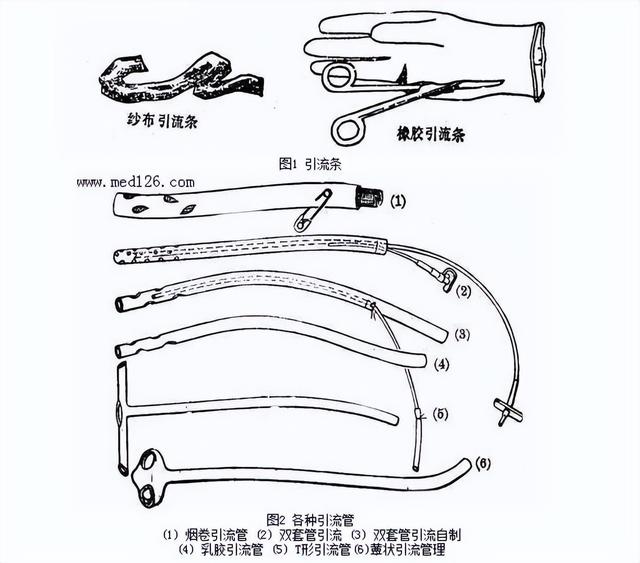 引流是什么病，肚子插管引流是什么??？
